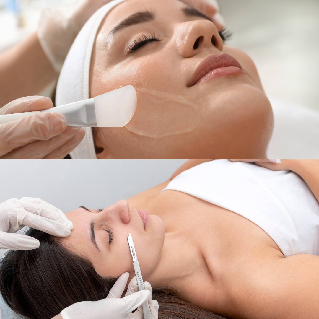 Dermaplaning And Chemical Peels